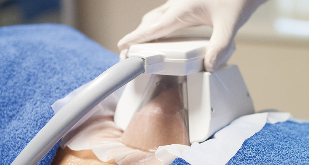How Fat Freezing and HIFU Work Together? 2 Multiple Areas in One Session HIFU and Fat Freezing Bedford