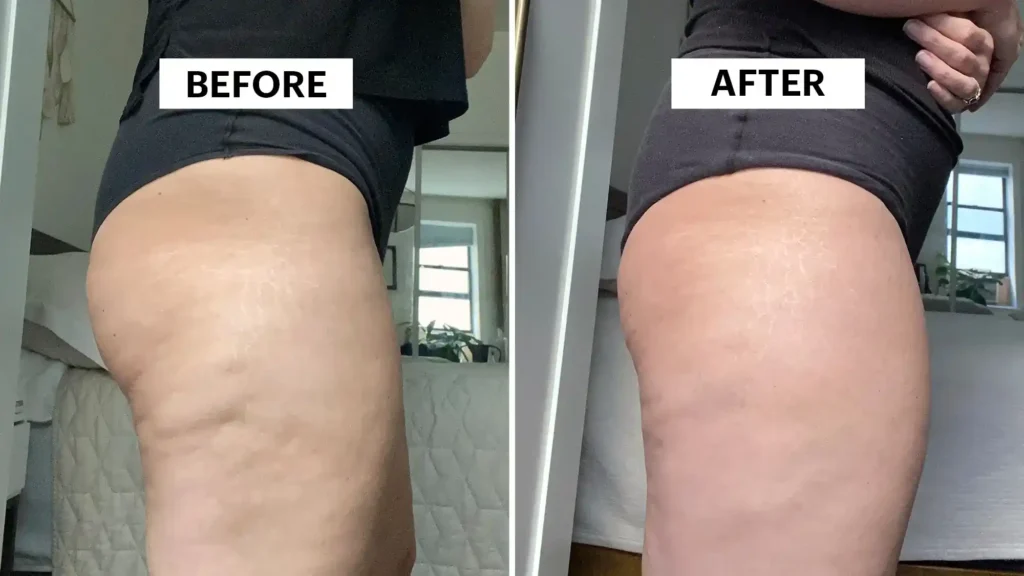 Do Toning Exercise Bedford Really Tackle Cellulite?