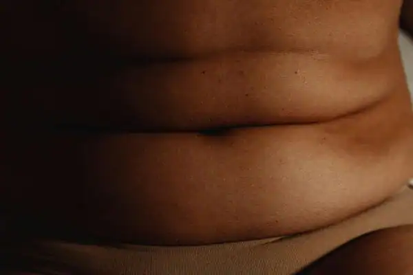 The Hidden Connection: How Stress Shapes Your Fitness and Body Composition 3 image of what stress can do on the stomach area and how Lipo 360 Bedford can help to change your body shape.